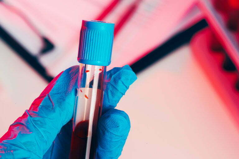 hands in blue gloves keep test tube with a blood